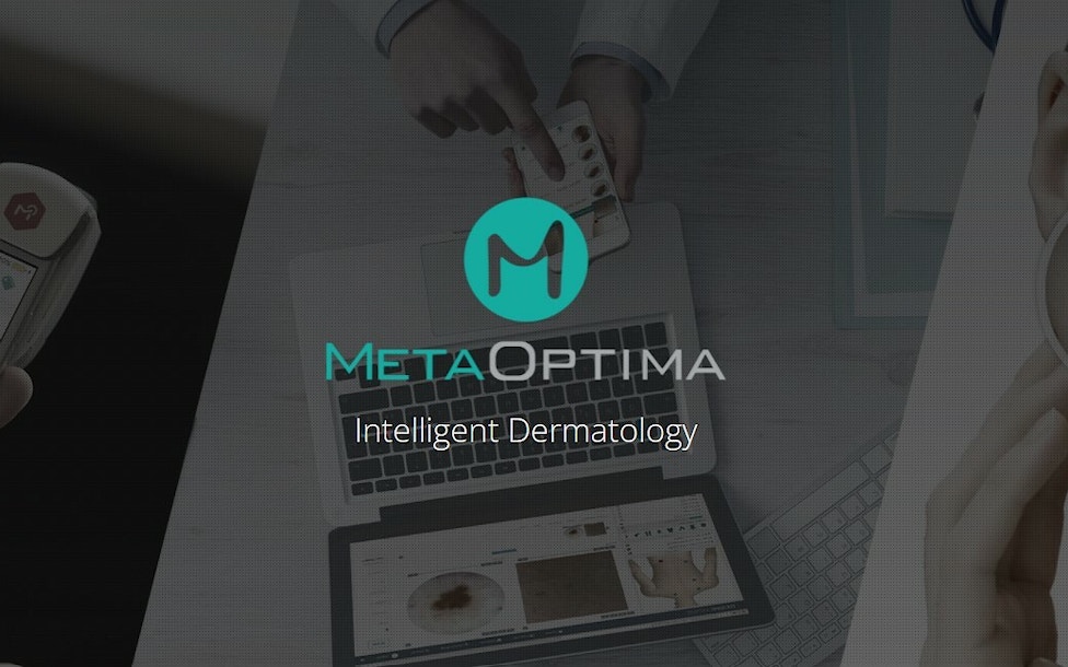 Case Study: MetaOptima Enhances Security Practices through a Web Application Assessment